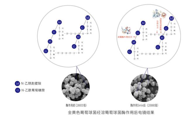 南宫28生物酶杀菌技术从“医”到“民”转化 生物蛋白酶湿巾受好评(图1)